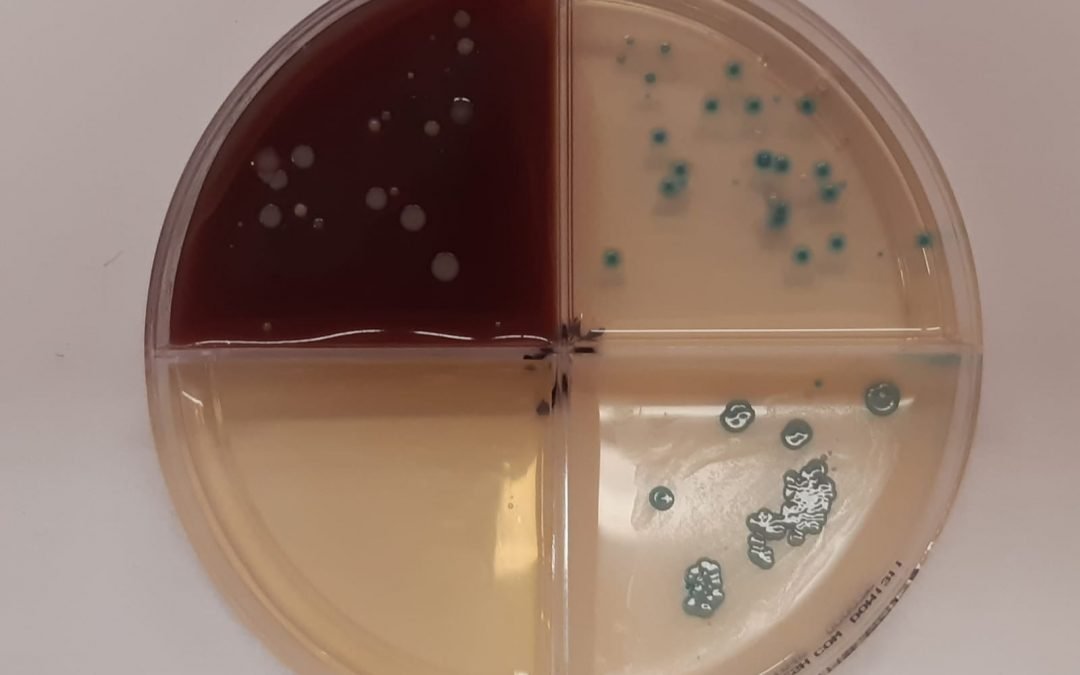 Rezistence na antibiotika a jak si ji v chovu nevytvořit